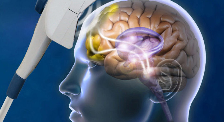 Transcranial Magnetic Stimulation during a Cross Road Maze to promote Spatial Memory Transcranial Magnetic Stimulation during a Cross Road Maze to promote Spatial Memory