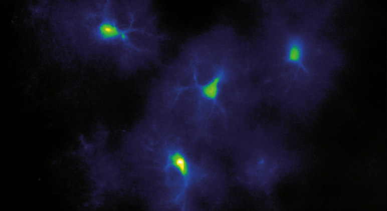 Deciphering Astrocyte-Neuron signaling communication in major depressive disorder Deciphering Astrocyte-Neuron signaling communication in major depressive disorder