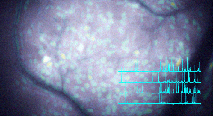 Activity patterns of striatal neurons Activity patterns of striatal neurons