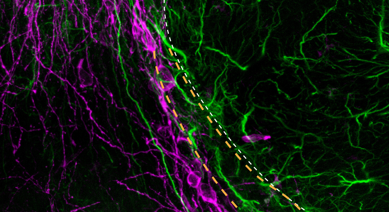 Adult Neurogenesis of Medium Spiny Neurons in the Nucleus Accumbens Adult Neurogenesis of Medium Spiny Neurons in the Nucleus Accumbens
