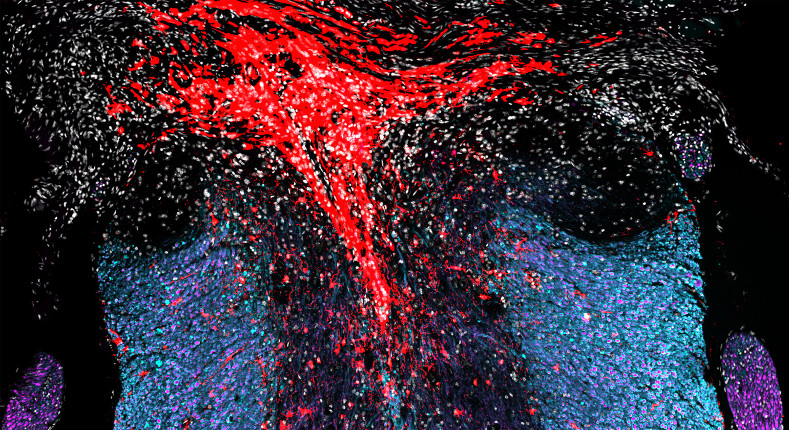 Latent regenerative potential in resident neural stem cells Latent regenerative potential in resident neural stem cells
