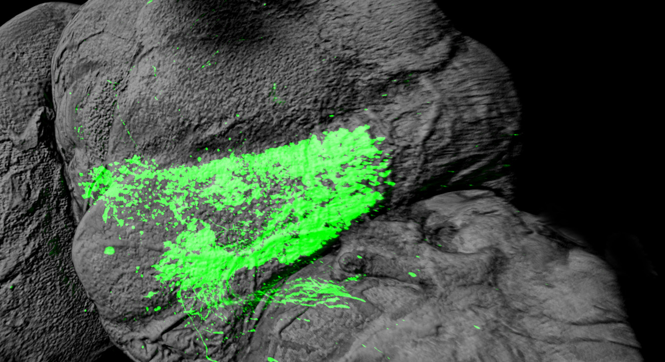 From commissural axon guidance to cerebellar circuits From commissural axon guidance to cerebellar circuits