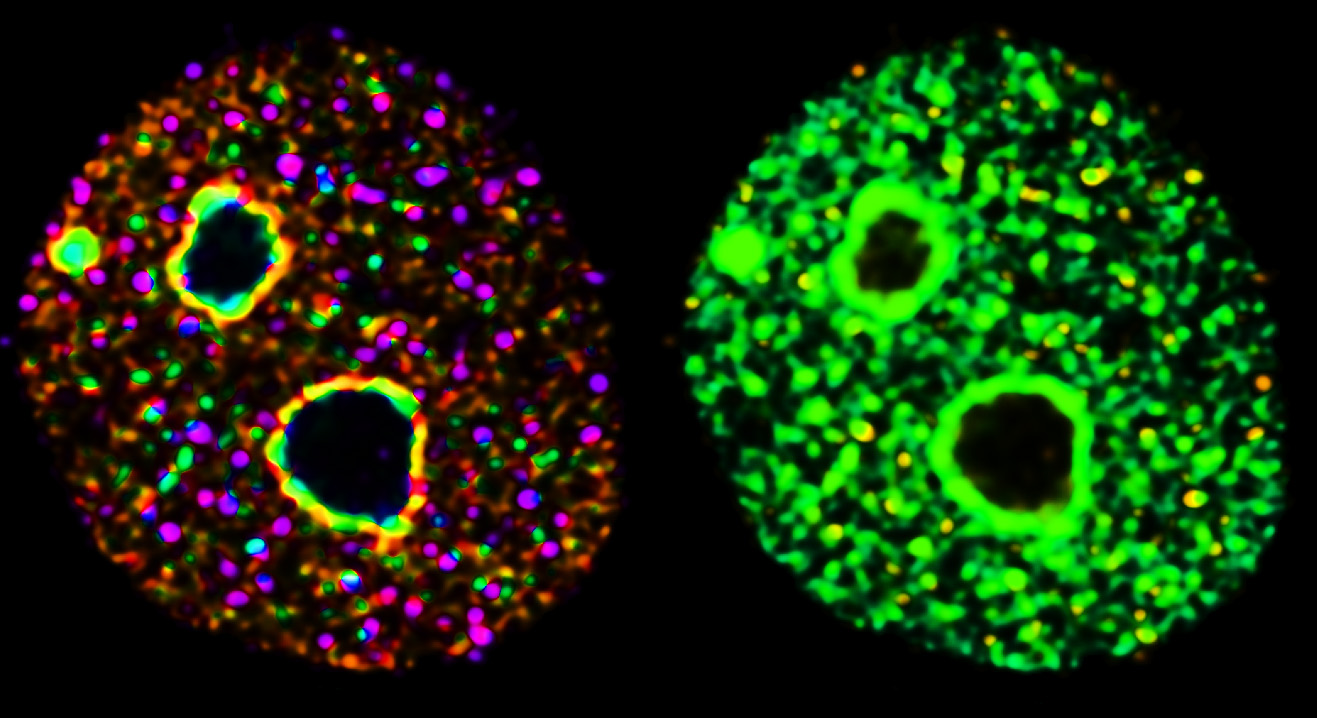 Trnp1 - the nuclear protein maintaining cells in a self-renewal state Trnp1 - the nuclear protein maintaining cells in a self-renewal state