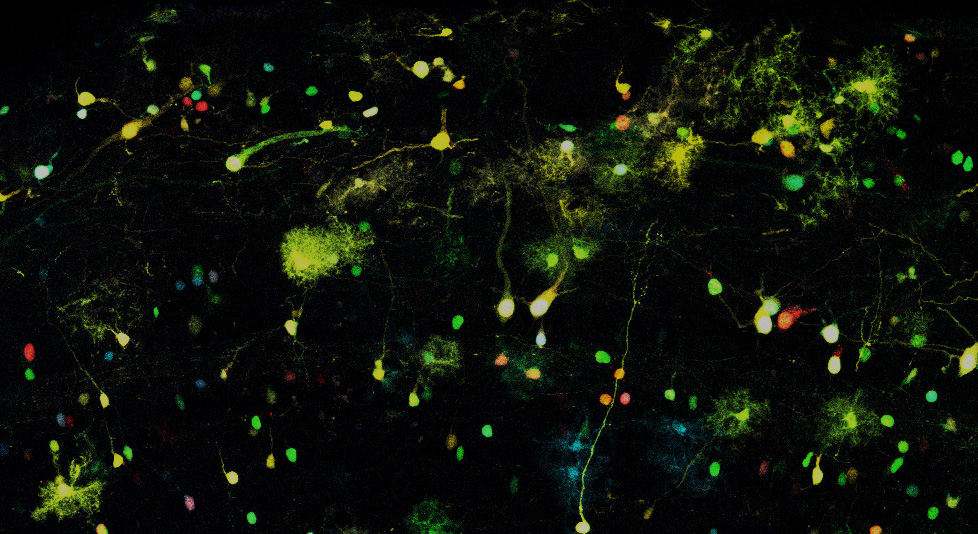 Decoding the Potential of Subpallial Neural Progenitor cells Decoding the Potential of Subpallial Neural Progenitor cells